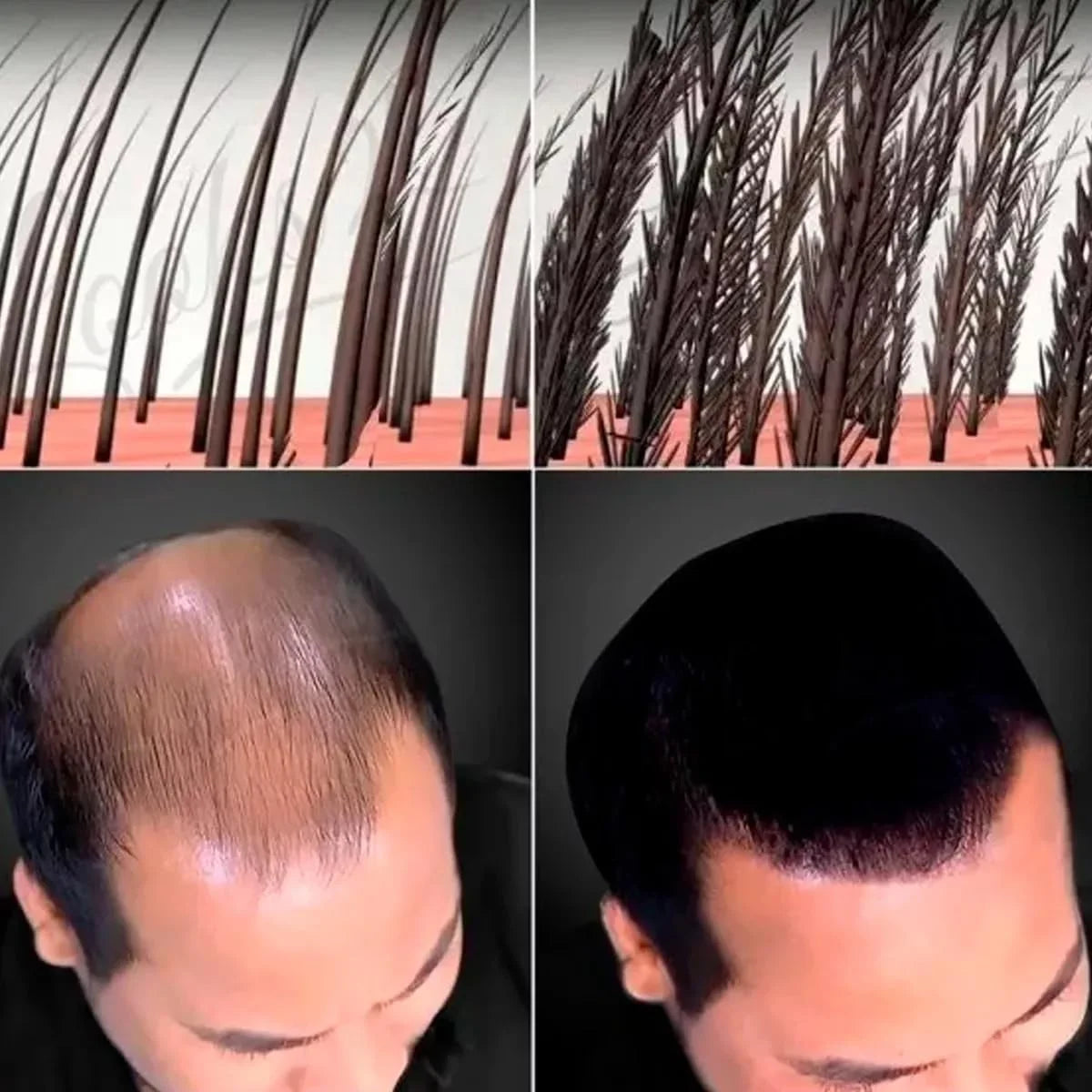 Fibras Capilares RegenPro: 50 Usos