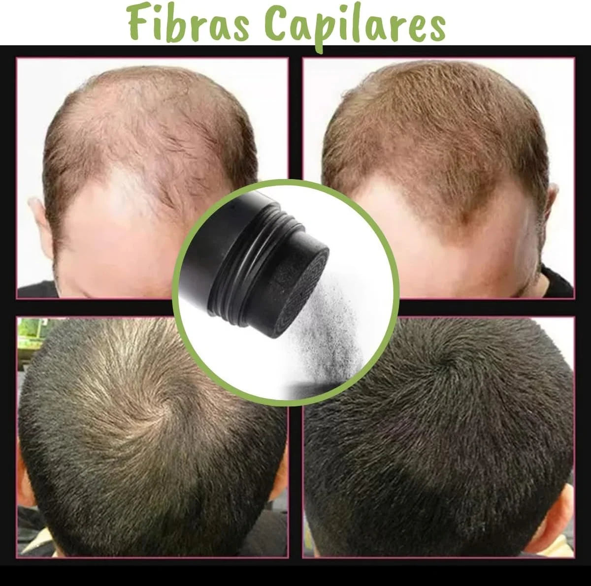Fibras Capilares RegenPro: 50 Usos